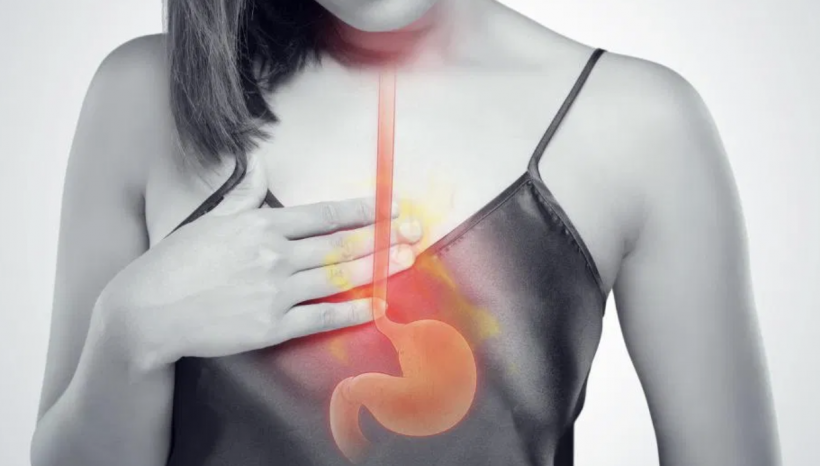 Acid Reflux – Root Causes & Solutions