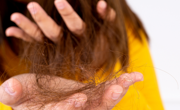 4 Possible Causes of Post-Covid Hair Loss